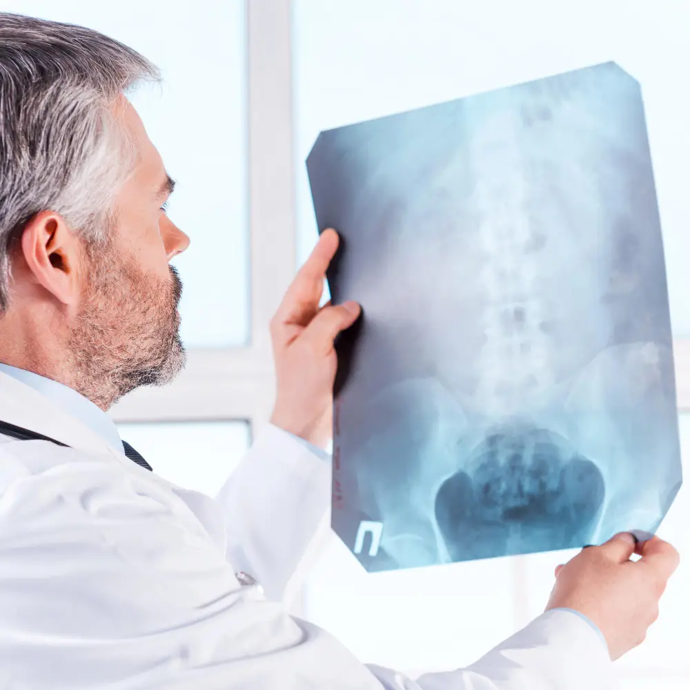 Spinal Cord Injury